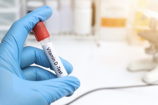 Vitamin - Mineral Analiz Testleri